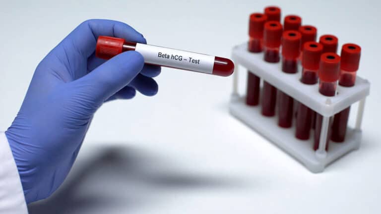 Test beta hcg