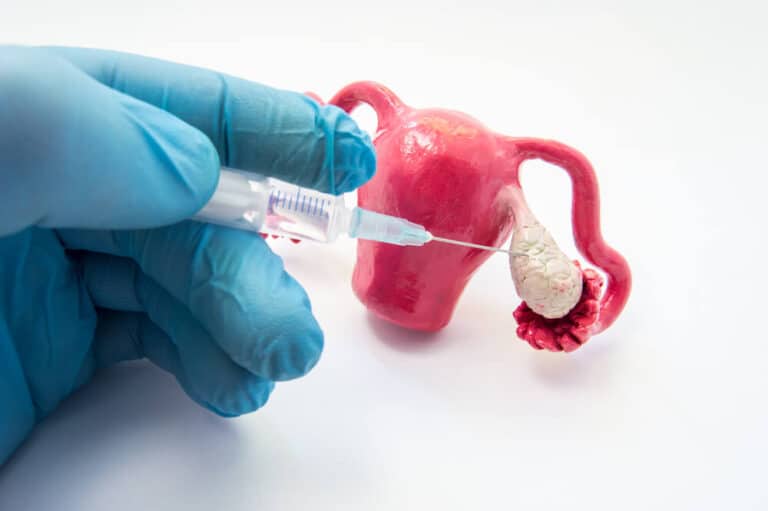 Stimolazione ovarica
