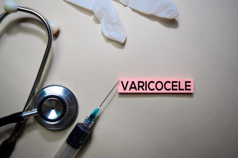 Varicocele pelvico femminile